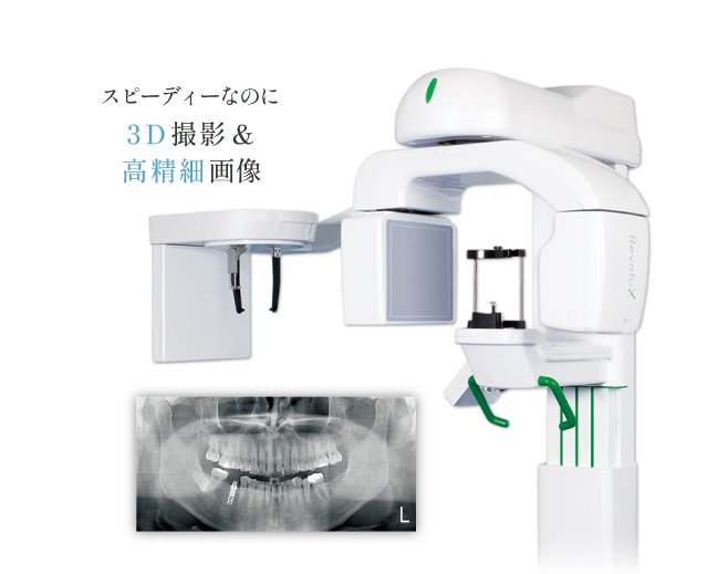 スピーディーなのに3D撮影＆高精細画像