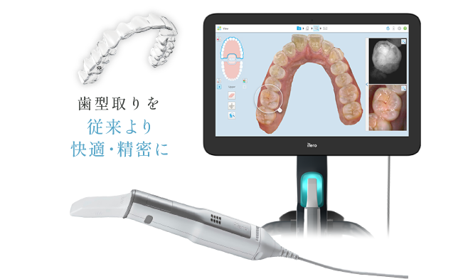 歯型取りを従来より快適・精密に